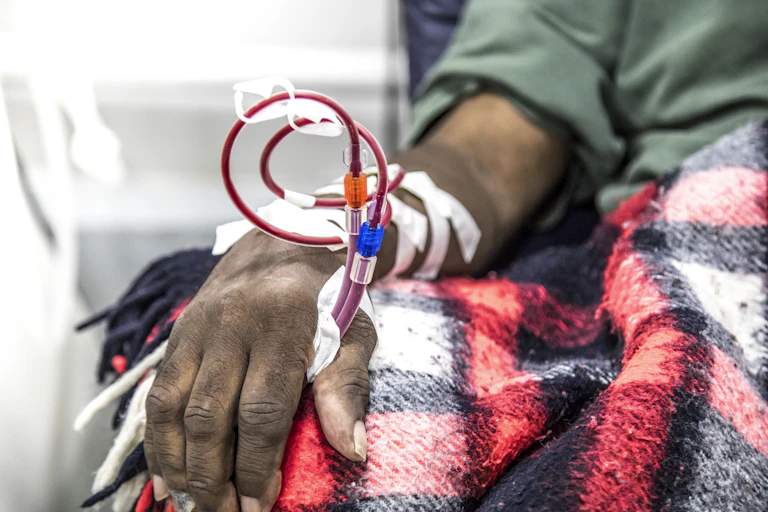 dialysis in people on the equipment