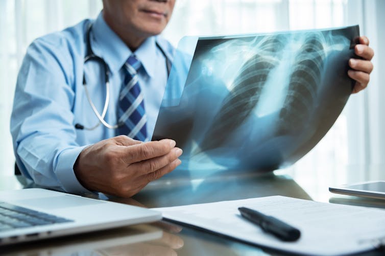 A doctor looks at an x-ray of lungs.