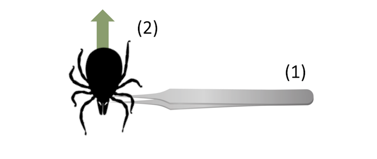 Infographic of how to remove a tick with the tweezers located near the head of the tick. There is an arrow pointed straight upwards from the back of the tick.