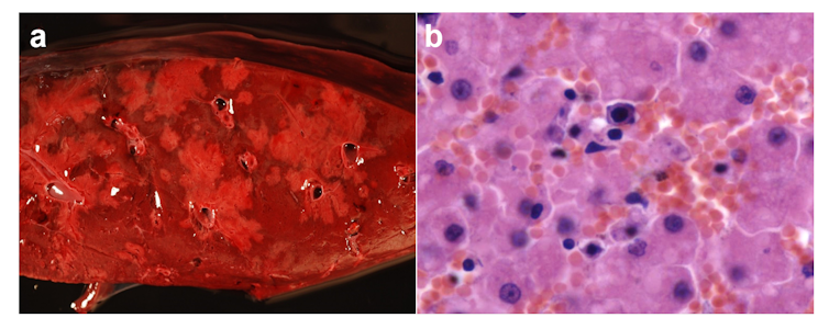 Hepatite infecciosa canina en oso pardo. Imaxe macroscópica (a) e microscópica (b) de fígado dun oso cuxa morte foi causada polo Adenovirus canino tipo 1 (CAdV-1), axente etiológico da hepatite infecciosa canina. Na imaxe microscópica obsérvase necrose de hepatocitos e infiltrado inflamatorio principalmente de linfocitos. Imaxe achegada polos autores.