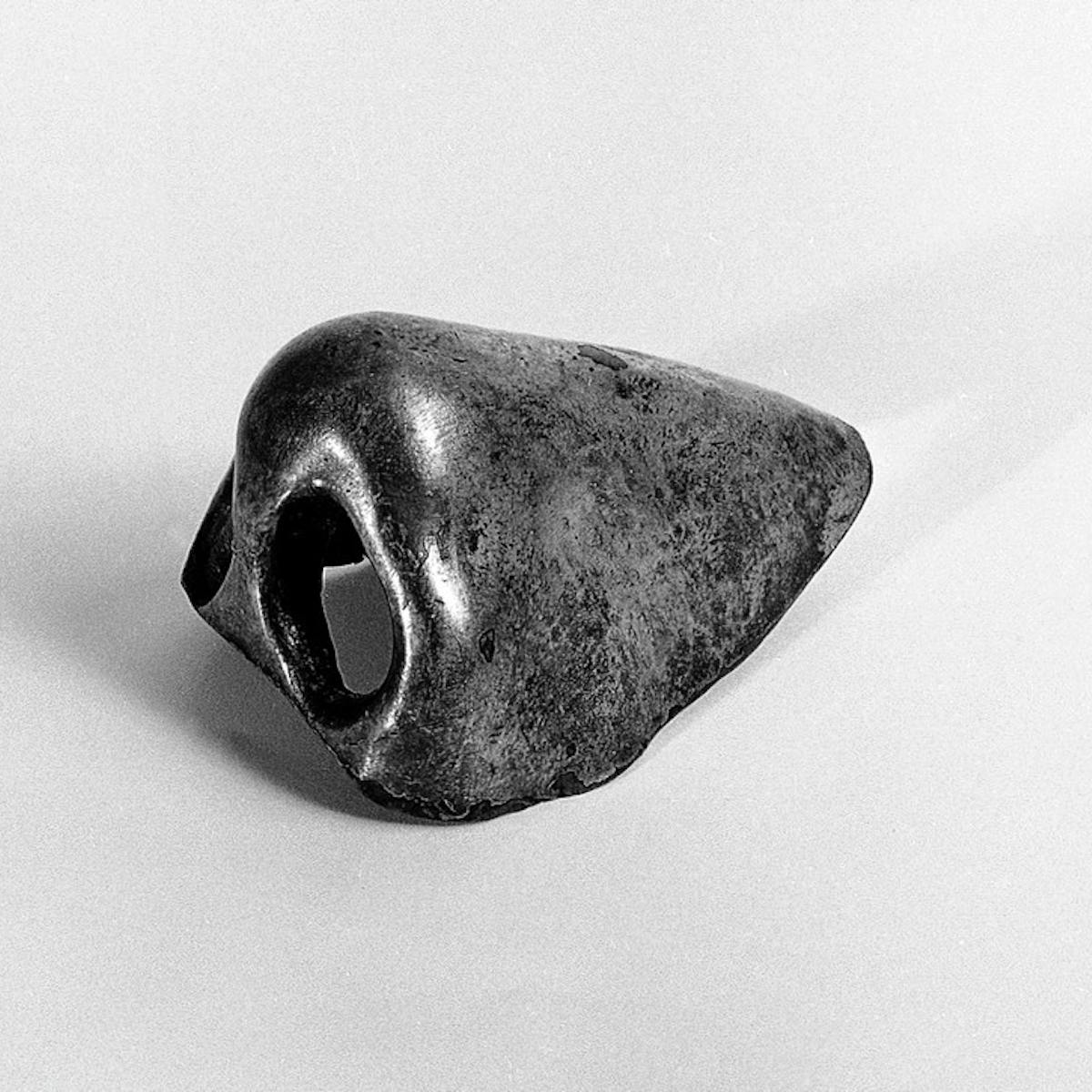 This 400 Year Old Botched Nose Job Shows How Little Our Feelings About Transplants Have Changed This 400 Year Old Botched Nose Job Shows How Little Our Feelings About Transplants Have Changed