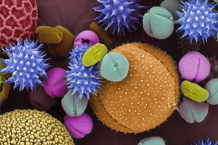 Pollen grains shown through a scanning electron microscope and colorized