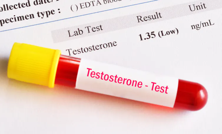 Image of a test tube labelled