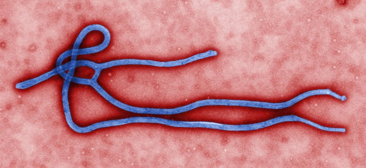 Ebola virus virion.