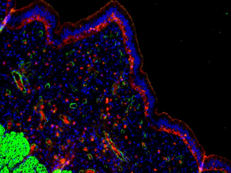 Meet the Egyptian spiny mouse: this menstruating rodent may help us understand human pregnancy