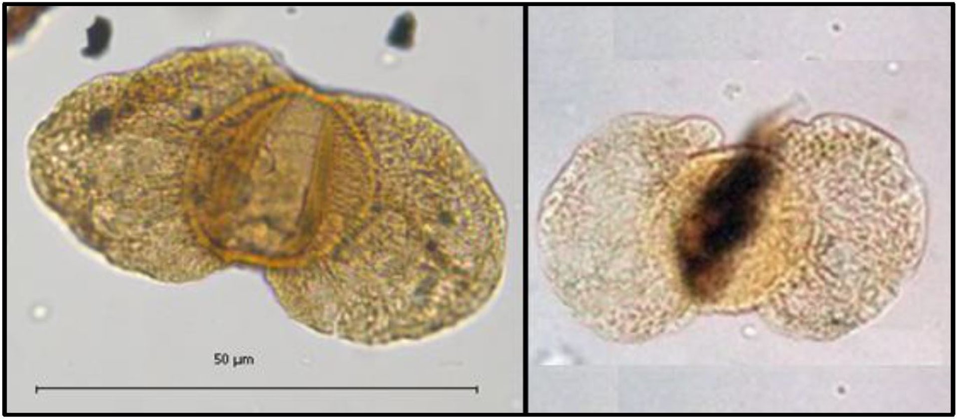 how and when did Mount Everest become the tallest mountain? And will it remain so?