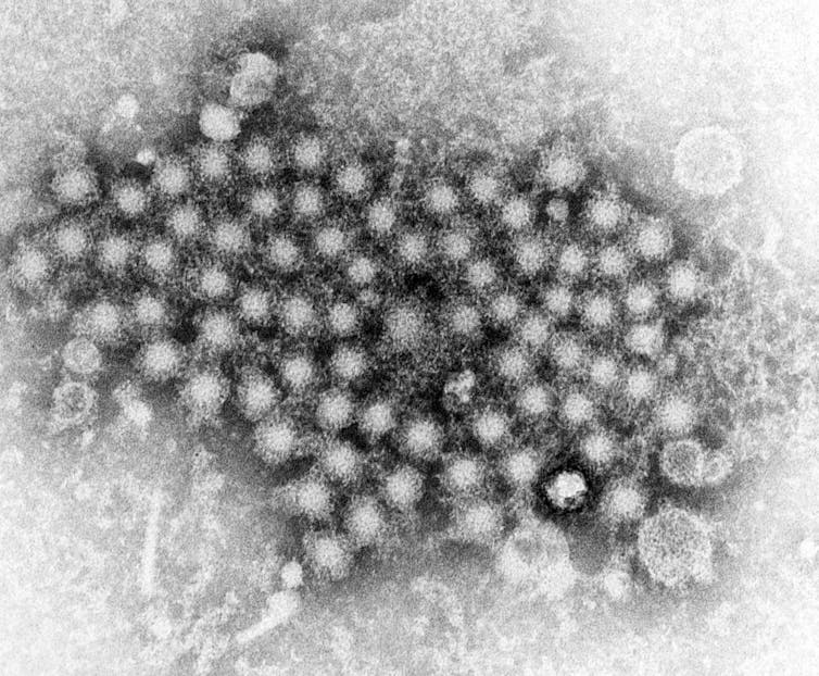Black and white microscopic image showing a cluster of dots.