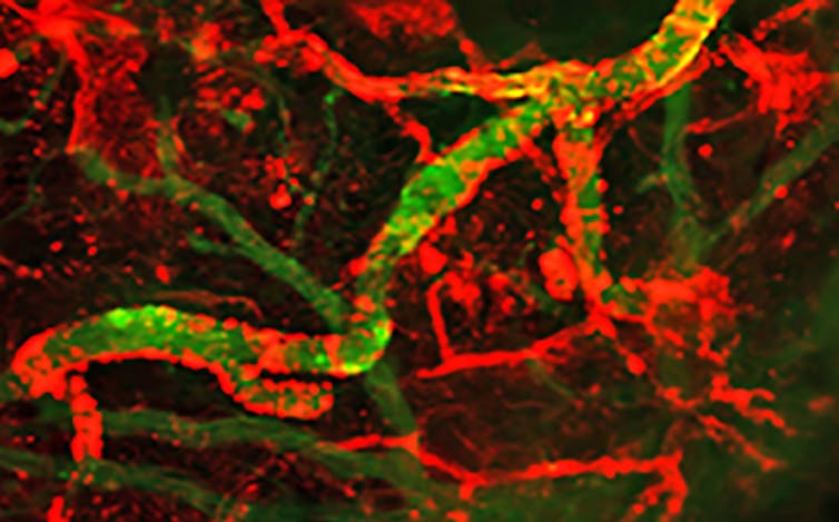 Nanopartículas no cerebro, vasos sanguíneos en verde e nanopartículas en vermello.