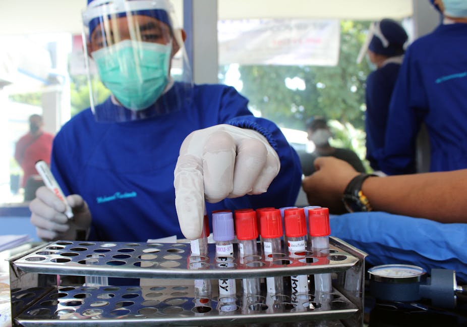 terapi plasma konvalesen dalam pengobatan COVID-19