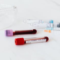 (Two vials of blood and blood-drawing equipment)