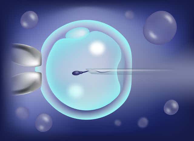 Injecting sperm into egg