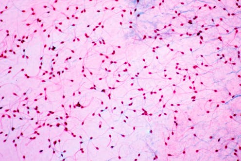 Male fertility: how everyday chemicals are destroying sperm counts in humans and animals