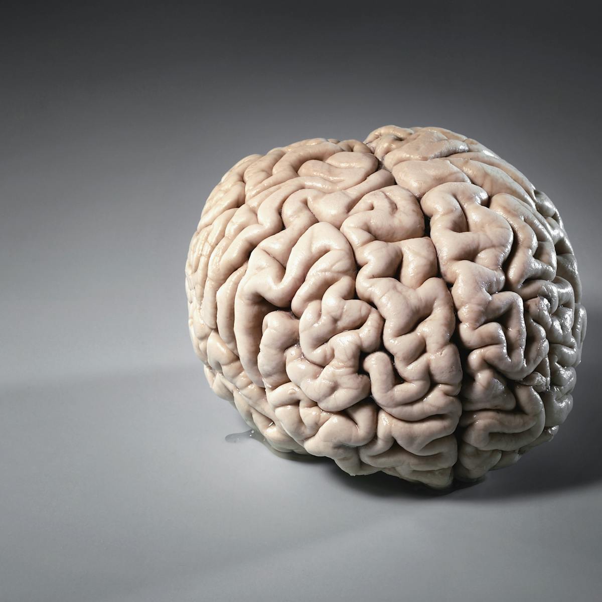 You Don T Have A Male Or Female Brain The More Brains Scientists Study The Weaker The Evidence For Sex Differences