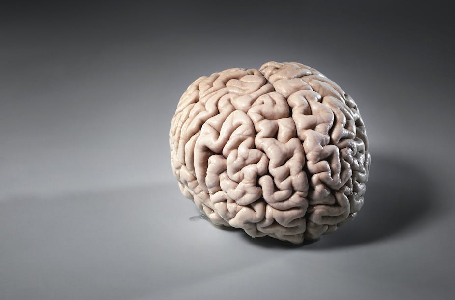 A photo of a human brain resting on a grey surface.