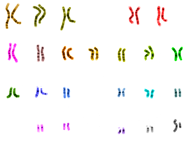 The 23 human chromosomes in various colors. 