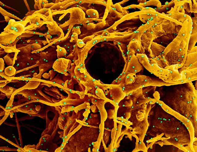 Electron micrograph of Orange cell with green virus particles that look like dots