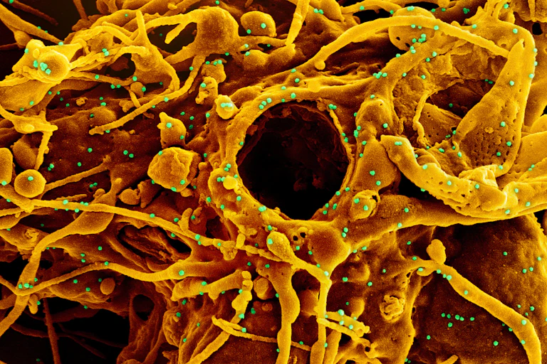 Electron micrograph of Orange cell with green virus particles that look like dots
