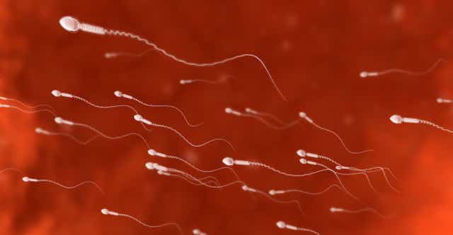 Several sperm cells swimming against red background