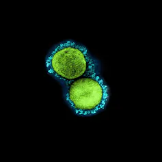 Electron micrograph of B.1.1.7 variant of SARS-CoV showing the protein spikes in blue