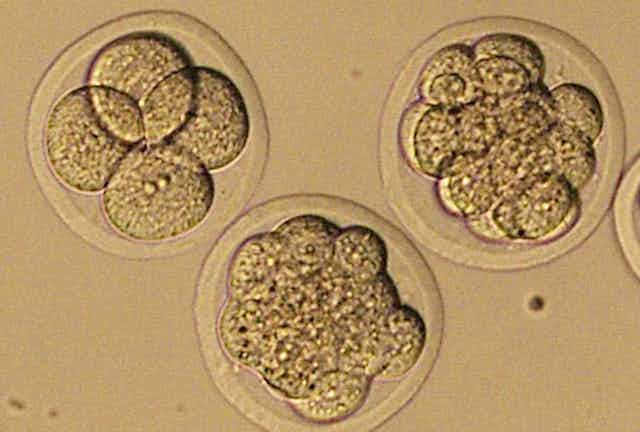 Three embryos showing four, eight and 16 cells.