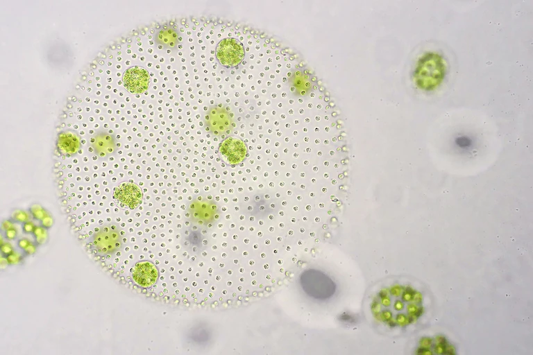 A group of phytoplankton under the microscope.