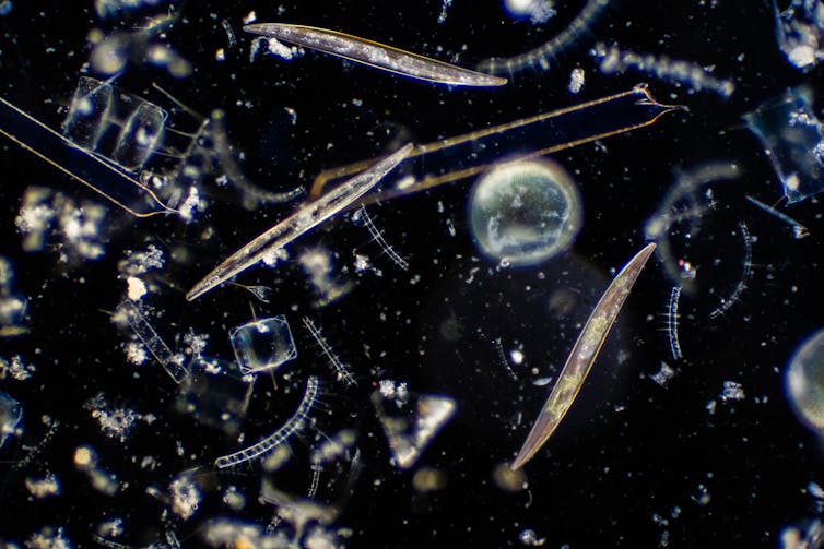 A few different types of phytoplankton under a microscope, in various shapes, with a black background.