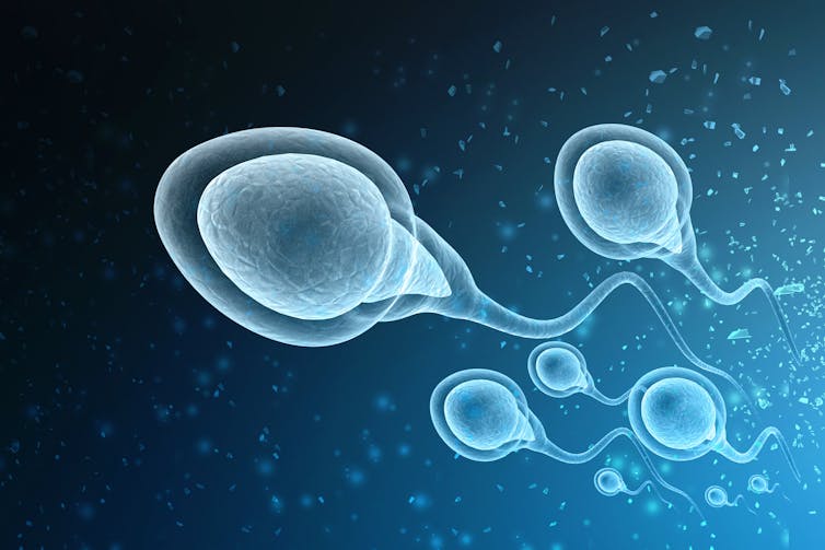 An illustration of sperm.