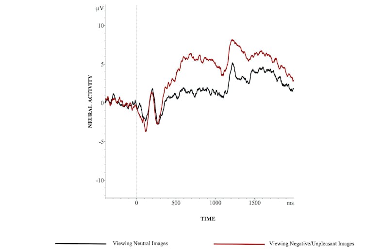 visualization of brain electrical activity over time