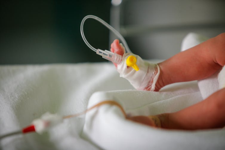 A preterm baby in an incubator
