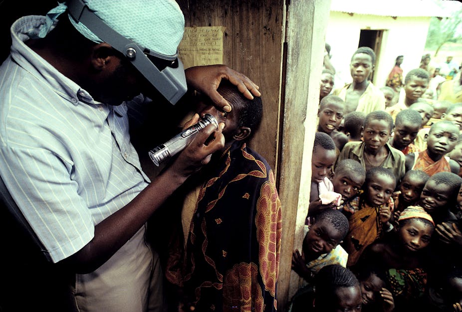 A Ministry of Health worker with opthamology training, Sidney Katala, examines a child for signs of tracoma 1992 in Kongwa, Tanzania. 