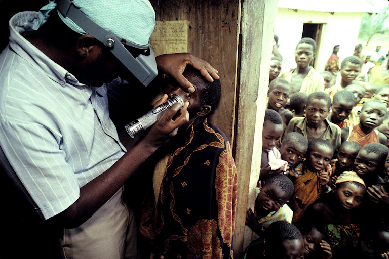 A Ministry of Health worker with opthamology training, Sidney Katala, examines a child for signs of tracoma 1992 in Kongwa, Tanzania.