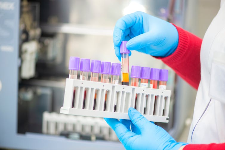 Person puts blood test tube into rack.