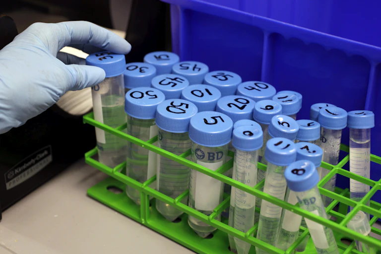Hand reaching for stem cell test tube from a rack