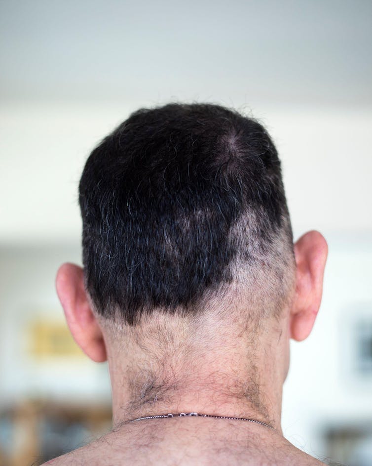 Back of man's head with an uneven haircut
