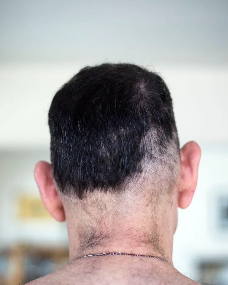Back of man's head with an uneven haircut