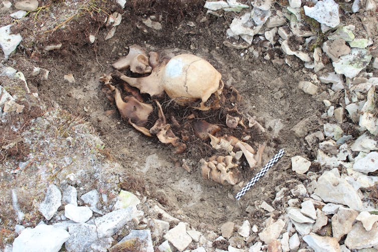 human skull and remains found buried
