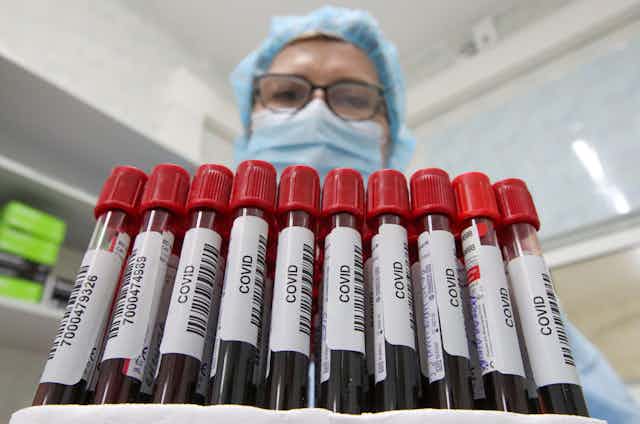 A healthcare worker holds vials with blood samples while performing laboratory tests which detect immunoglobulin class G (IgG) antibodies to SARS-CoV-2 virus in blood