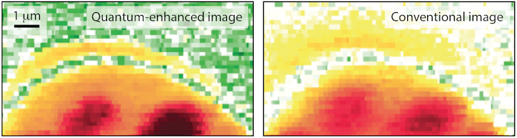 A quantum hack for microscopes can reveal the undiscovered details of life