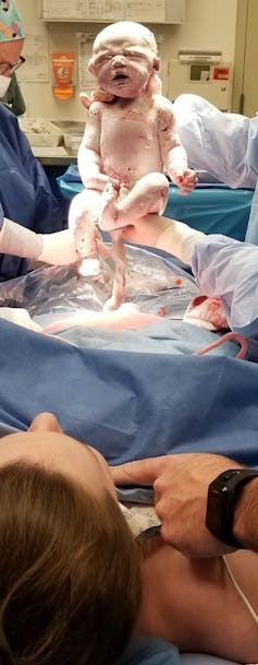 Caesarean birth choice