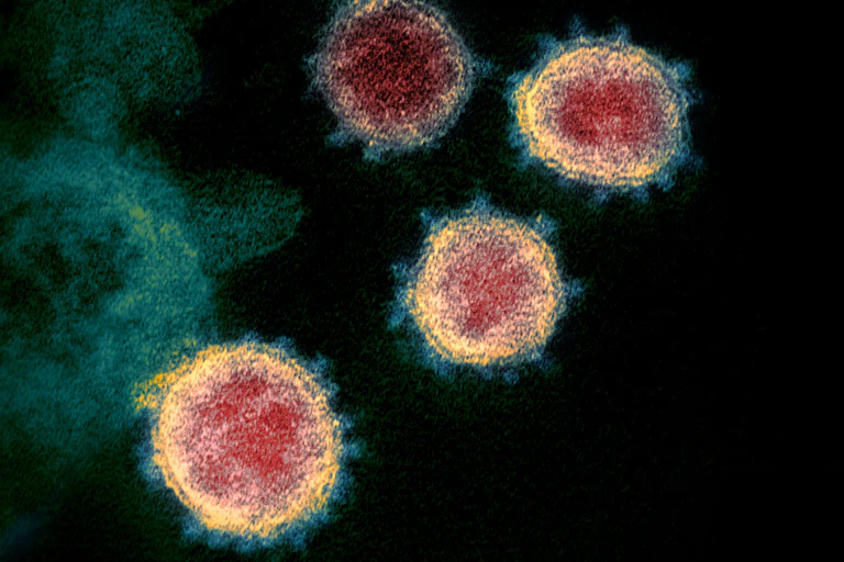 SARS-CoV-2 as seen using a transmission electron microscope