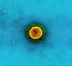 Electron micrograph of a yellow virus particle with green spikes, against a blue background.