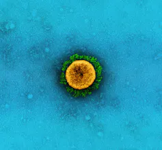 Electron micrograph of a yellow virus particle with green spikes, against a blue background.