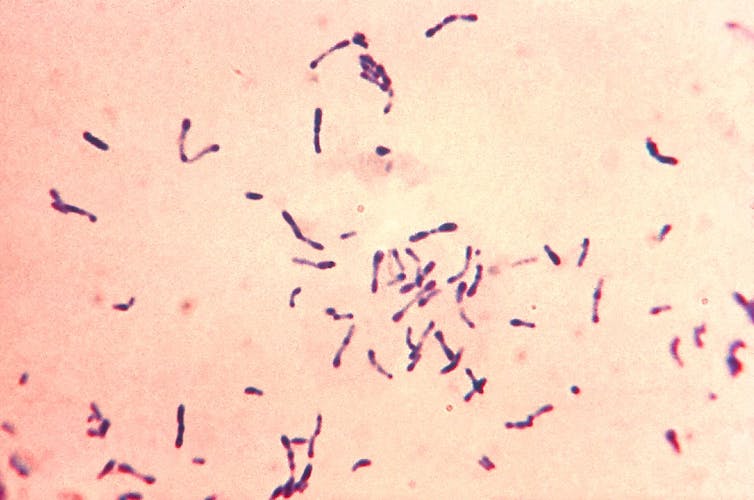 A pink microscope slide with purple bacterial cells.
