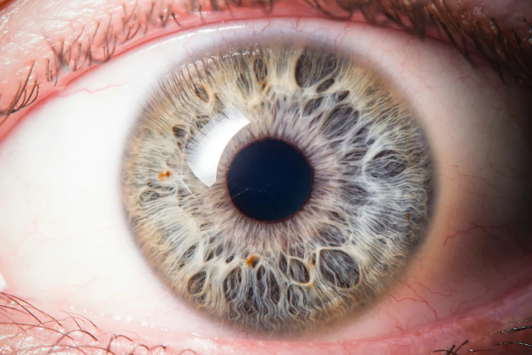 A close-up of the human eye