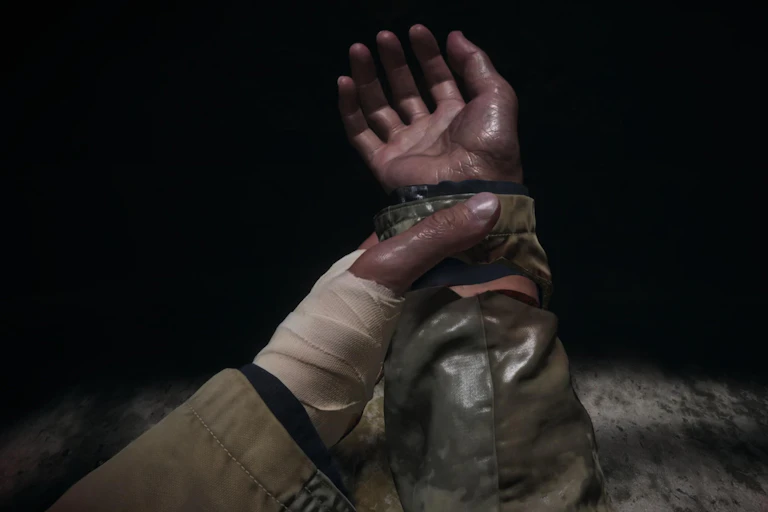 A bandaged hand grips the other hand.