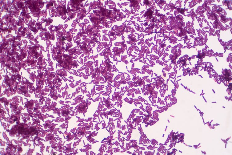 A microscope view of rod-shaped bacteria stained purple.