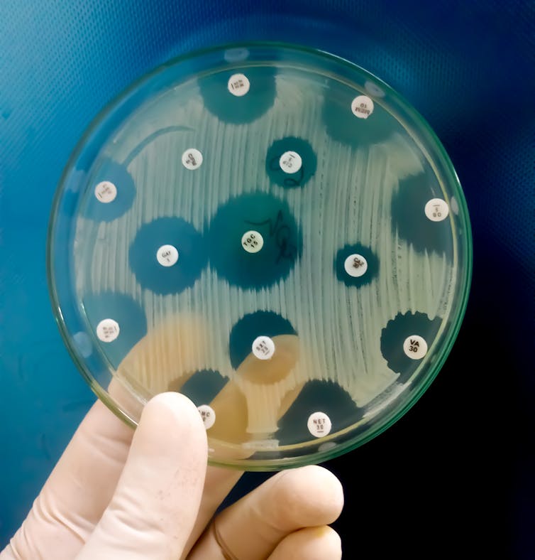 Hand holding a petri dish containing bacteria.