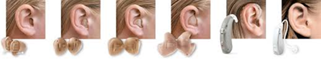 Différents types de prothèses auditives selon les degrés de surdité © https://lanielaudio.com/ (via The Conversation)