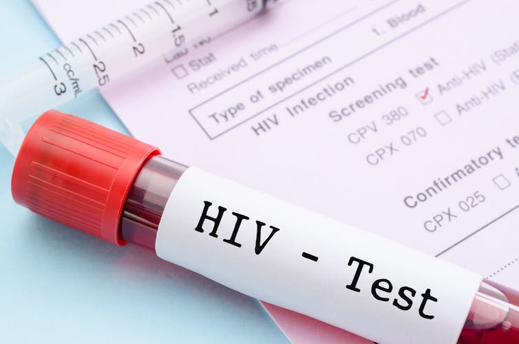 Blood sample labelled with HIV - Test