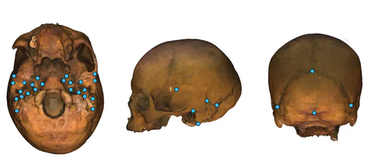 Three images of a skull from different perspectives